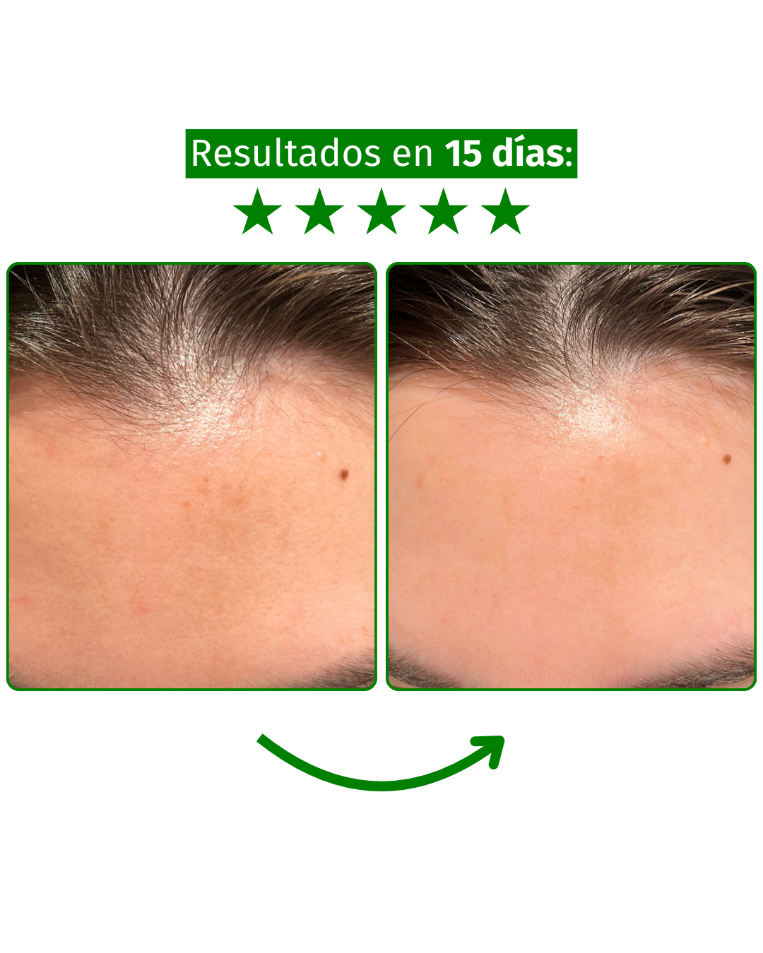 Serum Baku-Retinol